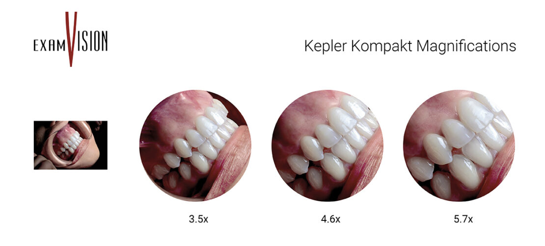 Powiekszenia lupy stomatologiczne i chirurgiczne Kepler Kompakt