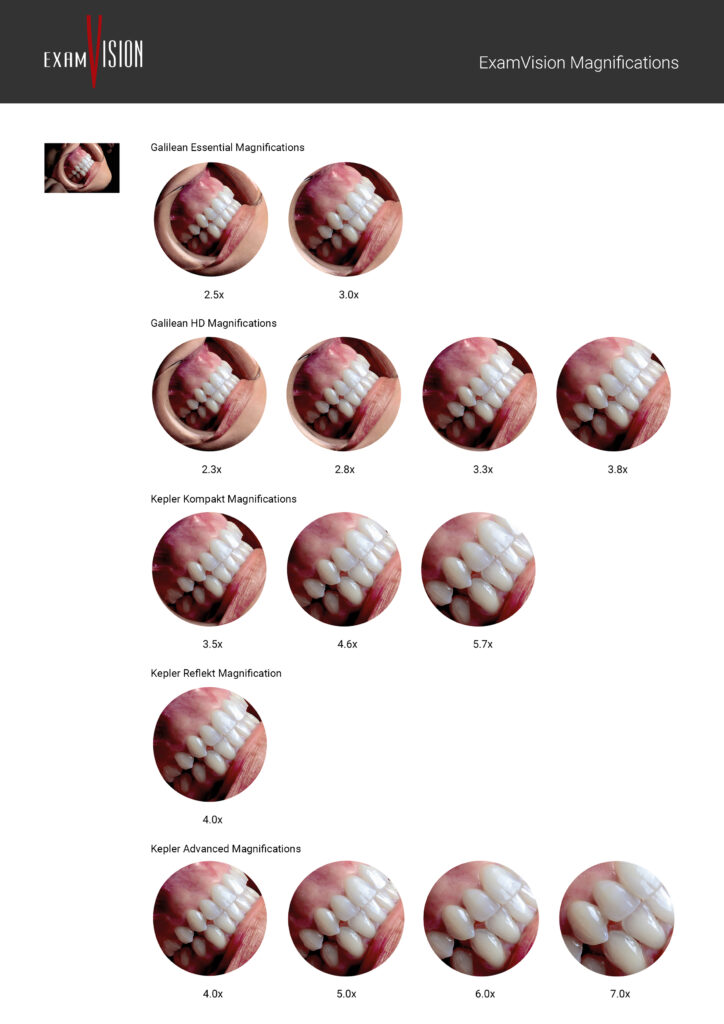 Powiekszenia lupy ExamVision