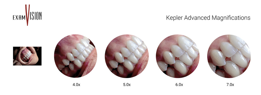 Lupy Kepler Advanced zmienne powiększenie
